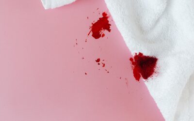 Remove Blood Stains